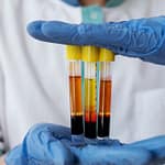 How PRP Injections Work: Harnessing Your Body's Healing Power