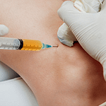 Low-Impact Diet, High-Impact Results, Foods for Post-PRP Knee Recovery